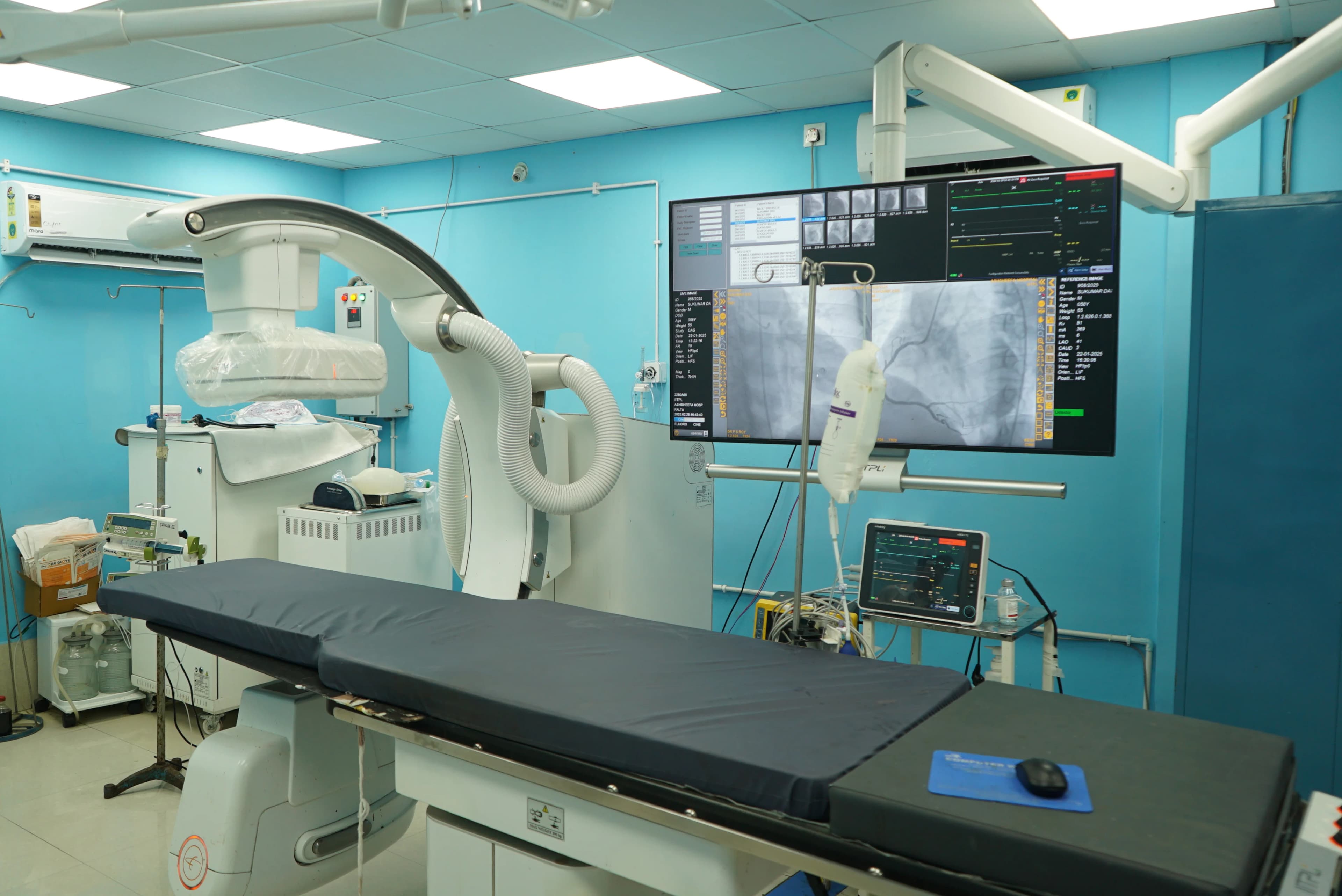 Cardiac Tomography